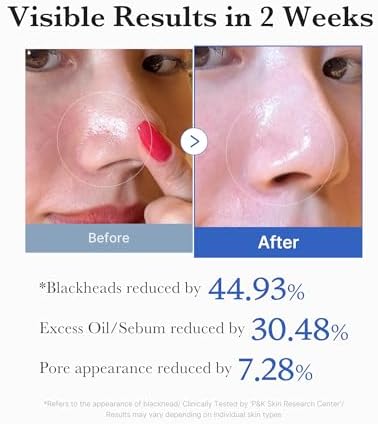 Medicube Zero Pore Pads 2.0, Dual-Textured Facial Toner Pads for Exfoliation and Pore Care with 4.5% AHA Lactic Acid & 0.45% BHA Salicylic Acid, Ideal for All Skin Types, Korean Skin Care (70 units)