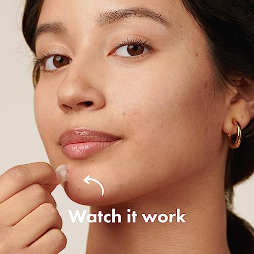 Mighty Patch™ Original patch from Hero Cosmetics – The #1 Hydrocolloid Acne Pimple Patch for Shrinking Zits and Whiteheads in 1 use; Nighttime Spot Stickers for Face and Skin (72 Count)