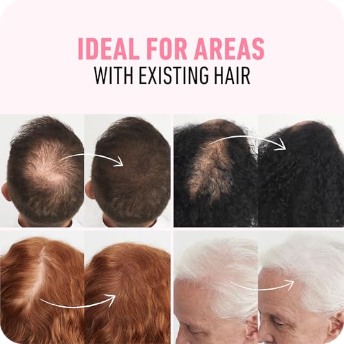 BOLDIFY Hair Fibers (28g) - Fill In Thinning and Fine Hair for an Instantly Fuller, Thicker Look - 14 Shades for Women & Men - Dark Auburn