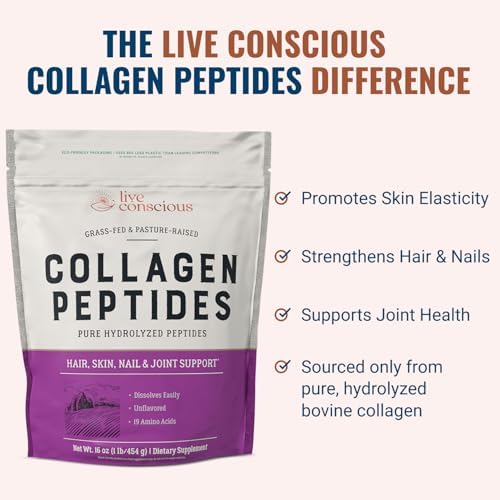 Collagen Peptides Powder - Naturally-Sourced Hydrolyzed Collagen Powder - Hair, Skin, Nail, and Joint Support - Type I & III Grass-Fed Collagen Supplements for Women and Men - 41 Servings - 16oz