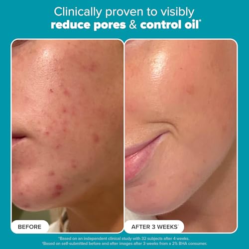 Paula's Choice SKIN PERFECTING 2% BHA Liquid Exfoliant Polish, Salicylic Acid Facial Exfoliator Polish for Enlarged Pores, Wrinkles & Fine Lines, Suitable for Blackhead-Prone Skin, Fragrance-Free