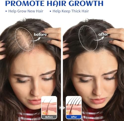 HIQILI 1000ML Rosemary Oil for Hair Growth, Add to Shampoo & Conditioner, 100% Pure Undiluted - 32 Fl Oz