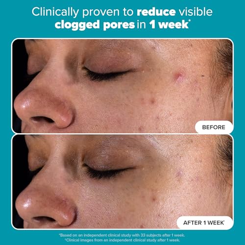 Paula's Choice SKIN PERFECTING 2% BHA Liquid Exfoliant Polish, Salicylic Acid Facial Exfoliator Polish for Enlarged Pores, Wrinkles & Fine Lines, Suitable for Blackhead-Prone Skin, Fragrance-Free