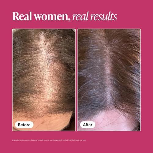 Viviscal Hair Growth Supplements For Women For Thicker, Fuller Hair, Nourishes Thinning & Loss, With Proprietary Collagen Complex, 60 Tablets, 1 Month Supply