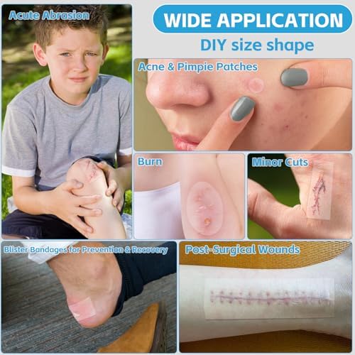 Hydrocolloid Bandages for Wound Care, Extra Large Medical-Grade Hydrocolloid Roll with Self-Adhesive, Ultra Absorbent, Flexible & Waterproof, DIY Size & Shape First Aid Kit Essential (2in*16ft)
