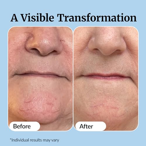 Vibriance Super C Serum for Mature Skin - All-in-One Vitamin Formula Hydrates, Firms, Lifts, Smooths, Targets Age Spots, Wrinkles, 1 fl oz