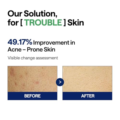 MEDIHEAL Teatree Trouble Facial Toner Pads with Tea Tree & Lactobacillus - Calming & Soothing for Sensitive & Acne Prone Skin - Vegan Face Gauze, 100 Pads