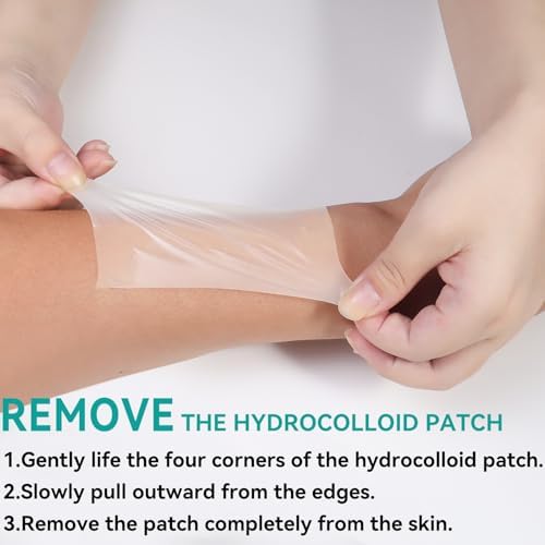 Upadated Hydrocolloid Bandages,2in*5ft Hydrocolloid Roll for Wound Care,Medical-Grade Hydrocolloid Patch Bandages with Self-Adhesive, Flexible & Waterproof DIY Size & Shape (2in*16ft)