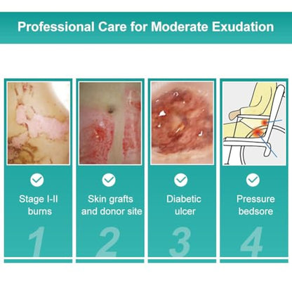 Dimora Hydrocolloid Dressing 4" x 4" for Wound Care, 10 Pack Large Patch Bandages with Self-Adhesive for Bedsore, Burn, Blister, Acne Care, Super Absorbent for Fast Healing