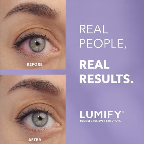 LUMIFY Redness Reliever Eye Drops, for Whiter & Brighter Looking Eyes, 0.25 Fl Oz (7.5 mL)