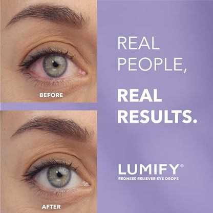 LUMIFY Redness Reliever Eye Drops, for Whiter & Brighter Looking Eyes, 0.25 Fl Oz (7.5 mL)