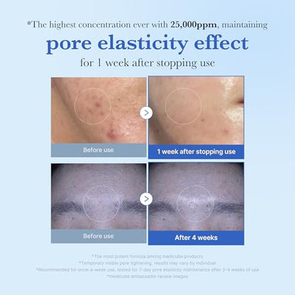 medicube Zero Exosome Shot 25,000 PPM Spicule Facial Serum | Liquid Skin Booster Serum | Exosome, AHA+BHA+PHA | Pore Care, Dead Skin Cells, Skin Texture | Korean Skin Care 0.43 fl.oz