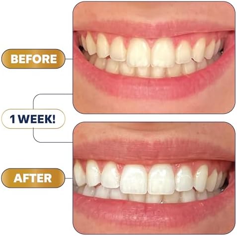 Lumineux Teeth Whitening Strips 21 Treatments – Peroxide Free - Enamel Safe for Whiter Teeth - Whitening Without The Sensitivity - Dentist Formulated - Sensitivity