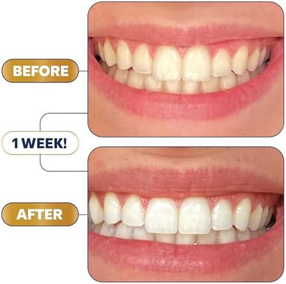 Lumineux Teeth Whitening Strips 21 Treatments – Peroxide Free - Enamel Safe for Whiter Teeth - Whitening Without The Sensitivity - Dentist Formulated - Sensitivity