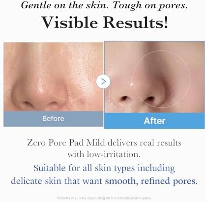 Medicube Zero Pore Pads Mild 2.0 (70 units) - Gentle Calming Toner Pads for Exfoliation, Minimizing Pores, and Blackhead Removal with PHA - Ideal for All Skin Types - Korean Skin Care