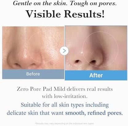Medicube Zero Pore Pads Mild 2.0 (70 units) - Gentle Calming Toner Pads for Exfoliation, Minimizing Pores, and Blackhead Removal with PHA - Ideal for All Skin Types - Korean Skin Care