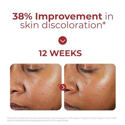 EltaMD UV Clear Tinted Face Sunscreen, SPF 46 Oil- Free with Zinc Oxide, Dermatologist Recommended