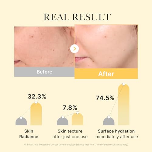 medicube Kojic Acid Turmeric Brightening Gold Jelly Gel Mask | Overnight Face Mask for Glass Glow Skin- Elasticity, Hydrating, Firming and Moisturizing | Korean Skincare, 28g x 4ea