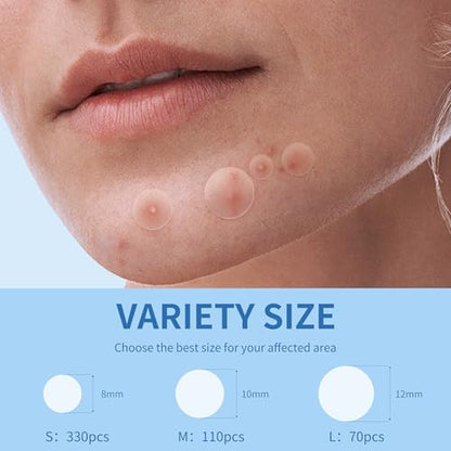 Pimple Patches for Face, 3 Size 510 Counts Hydrocolloid Acne Patches for Covering Zits and Blemishes, Spot Stickers with Salicylic Acid, Tea Tree Oil & Calendula Oil(8mm,10mm,12mm)