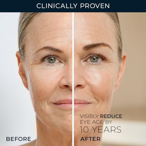 RoC Retinol Correxion Under Eye Cream for Dark Circles & Puffiness, Daily Wrinkle Cream, Anti Aging Line Smoothing Skin Care Treatment for Women and Men, 0.5 oz (Packaging May Vary)