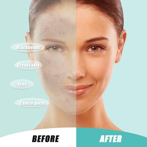 Face Towels, 10"×12" Disposable Face Towel, Face Towelettes XL, Ultra Soft Makeup Remover Dry Wipes, Thick Face Towel for Cleansing, 200 Count (4 Pack)