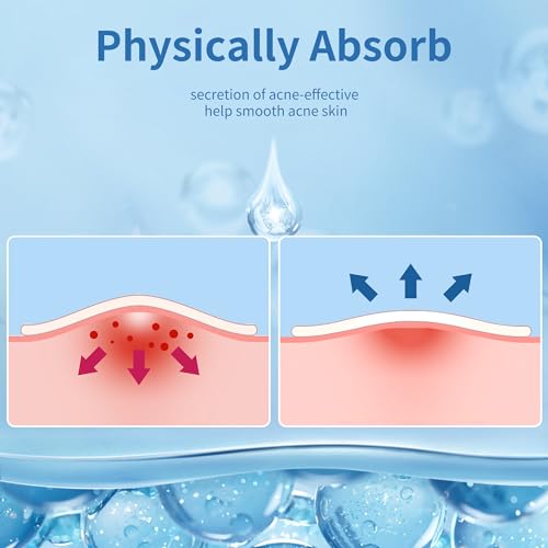 Pimple Patches for Face, 3 Size 510 Counts Hydrocolloid Acne Patches for Covering Zits and Blemishes, Spot Stickers with Salicylic Acid, Tea Tree Oil & Calendula Oil(8mm,10mm,12mm)