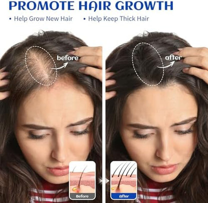 HIQILI Rosemary Oil for Hair Growth, Add to Shampoo & Conditioner, 100% Pure Undiluted - 16 Fl Oz