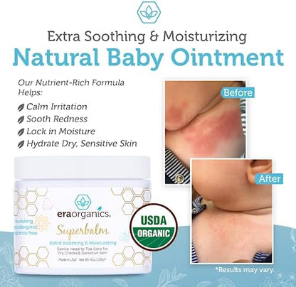 Era Organics Healing Ointment for Babies - USDA Certified Organic Natural Moisturizer Gentle on Sensitive Skin Prone To Baby Eczema, Cradle Cap (Infant Seborrheic Dermatitis), Rashes, Hives 4oz