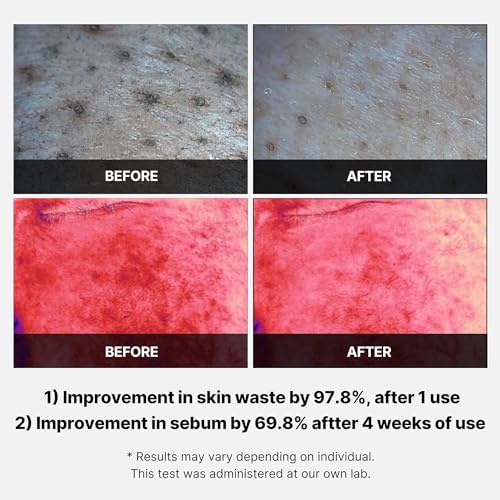 Medicube Red Succinic Acid Panthenol Facial Peeling Pads - Exfoliating Toner Pads for Breakout-Prone Skin with Niacinamide, AHA, BHA, and Soothing Panthenol - Non-Comedogenic