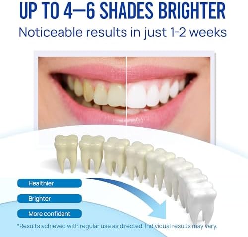 Teeth Whitening Pen Gel Kit: 35% Carbamide Peroxide Gel for Stain Removal - No Sensitivity with Remineralizing Pen for a Brighter Whiter Smile Mint