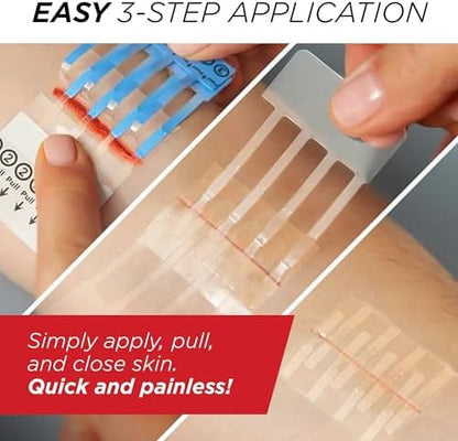 Clozex Emergency Laceration Closures - Repair Wounds Without Stitches, FSA HSA Eligible Skin Closure Device for 3 Individual Wounds Or Combine for Total Length of 4 1/4 Inches