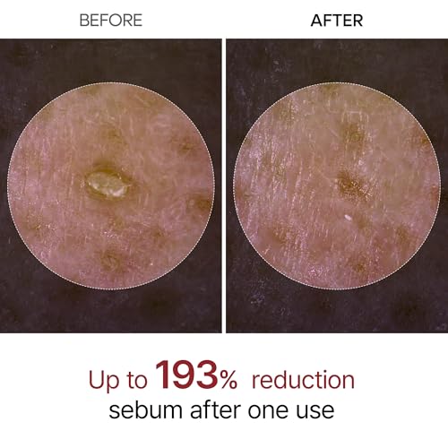 Peel Shot Glow White Rice Peeling Ampoule, Soft Exfoliating Face and Body Scrub Dead Skin Cells Remover for All Skin Types korean skin care 80ml