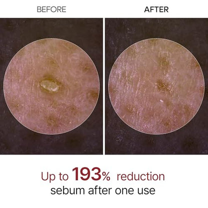 Peel Shot Glow White Rice Peeling Ampoule, Soft Exfoliating Face and Body Scrub Dead Skin Cells Remover for All Skin Types korean skin care 80ml