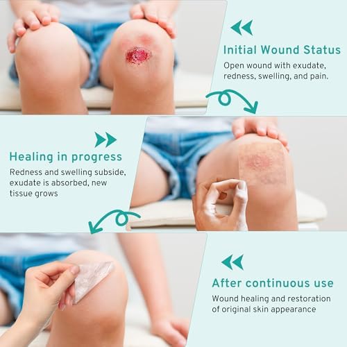 Upadated Hydrocolloid Bandages,2in*5ft Hydrocolloid Roll for Wound Care,Medical-Grade Hydrocolloid Patch Bandages with Self-Adhesive, Flexible & Waterproof DIY Size & Shape (2in*10ft)