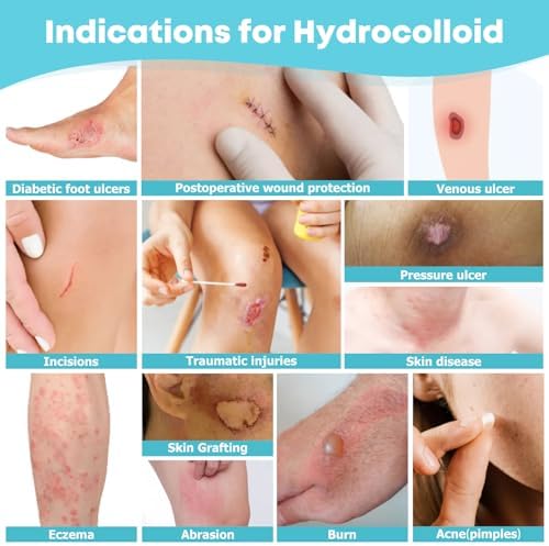 LIFARA Hydrocolloid Roll for Wound Care - Cut-to-Size, Extra Large Hydrocolloid Patch Bandages with Self-Adhesive, Ultra Absorbent, Flexible & Waterproof, First Aid Kit Essential (2in*16ft)