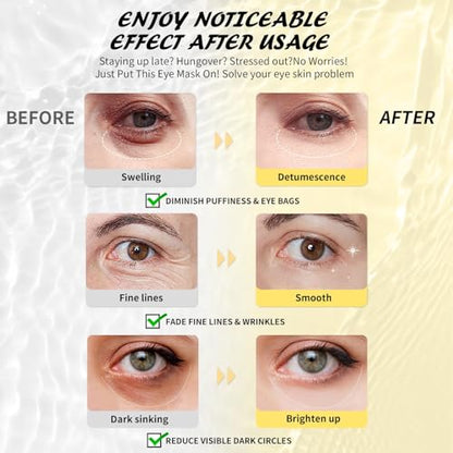 Under Eye Patches (50 Pairs), Hyaluronic Acid Eye Masks for Dark Circles Puffy Eyes Undereye Bags, Collagen Eye Patches for Wrinkles and Hydrate, Skin Care Gift for Her