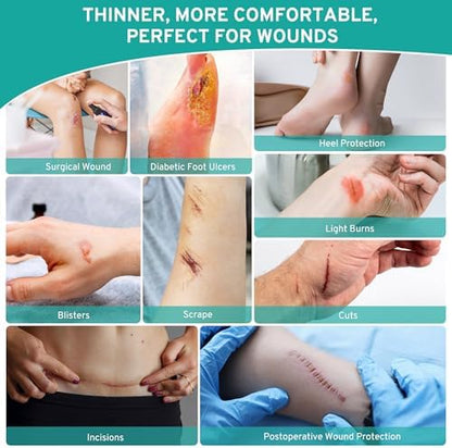 Upadated Hydrocolloid Bandages,2in*5ft Hydrocolloid Roll for Wound Care,Medical-Grade Hydrocolloid Patch Bandages with Self-Adhesive, Flexible & Waterproof DIY Size & Shape (2in*10ft)