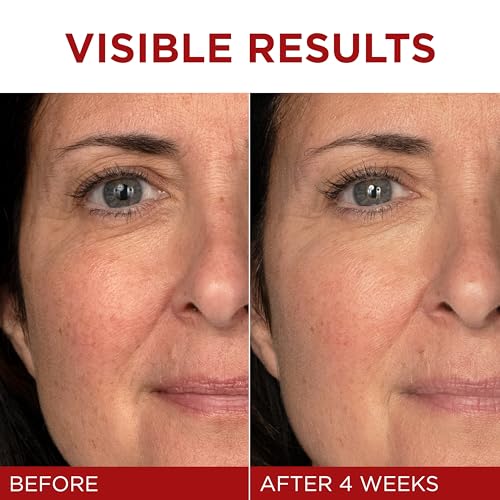 L'Oreal Paris Revitalift Triple Power Anti-Aging Face Moisturizer, Fragrance Free, Pro Retinol, Hyaluronic Acid & Vitamin C to Reduce Wrinkles, Firm & Brighten Skin, 2.55 Oz