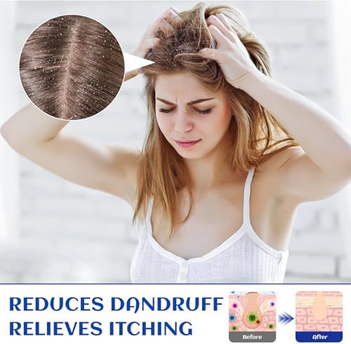 HIQILI Rosemary Oil for Hair Growth, Add to Shampoo & Conditioner, 100% Pure Undiluted - 16 Fl Oz