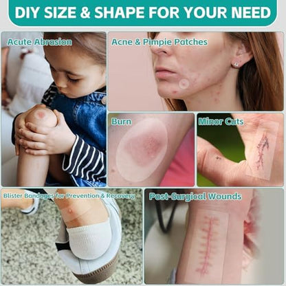 Upadated Hydrocolloid Bandages,2in*5ft Hydrocolloid Roll for Wound Care,Medical-Grade Hydrocolloid Patch Bandages with Self-Adhesive, Flexible & Waterproof DIY Size & Shape (2in*16ft)