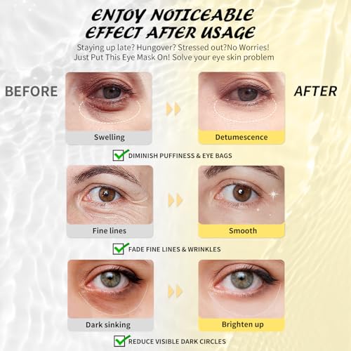 Under Eye Patches (30 Pairs), Caffeine Eye Masks for Dark Circles Puffy Eyes Undereye Bags, Collagen Eye Patches for Wrinkles and Puffiness, Skin Care Gift for Her