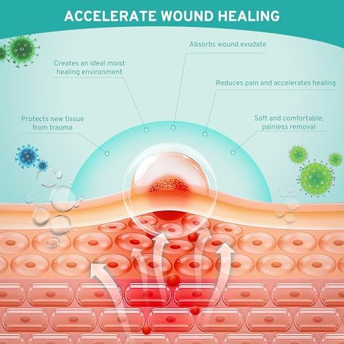 Upadated Hydrocolloid Bandages,2in*5ft Hydrocolloid Roll for Wound Care,Medical-Grade Hydrocolloid Patch Bandages with Self-Adhesive, Flexible & Waterproof DIY Size & Shape (2in*10ft)