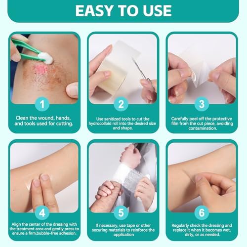 Upadated Hydrocolloid Bandages,2in*5ft Hydrocolloid Roll for Wound Care,Medical-Grade Hydrocolloid Patch Bandages with Self-Adhesive, Flexible & Waterproof DIY Size & Shape (2in*16ft)