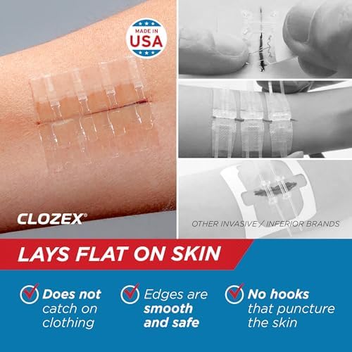 Clozex Emergency Laceration Closures - Repair Wounds Without Stitches, FSA HSA Eligible Skin Closure Device for 3 Individual Wounds Or Combine for Total Length of 3 3/8 Inches