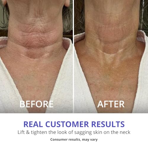 goPure Tighten and Lift Neck Cream - Clinically Tested - Pack of 2