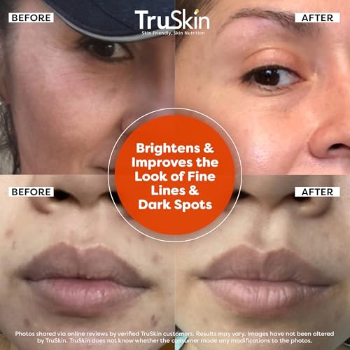 TruSkin Vitamin C Serum For Face – Anti Aging Face Serum with Vitamin C, Hyaluronic Acid, Vitamin E – Brightening Formula – Improve Appearance of Dark Spots, Tone, Fine Lines & Wrinkles, 2 Fl Oz