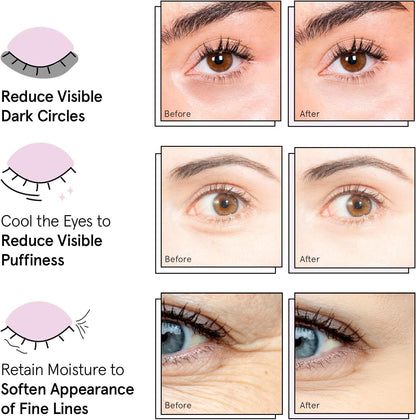 grace & stella Award Winning Under Eye Mask Reduce Dark Circles, Puffy Eyes, Undereye Bags, Wrinkles, Gel Under Eye Patches, Birthday Gifts for Women - Vegan Cruelty-Free Self Care (24 Pairs, Blue)