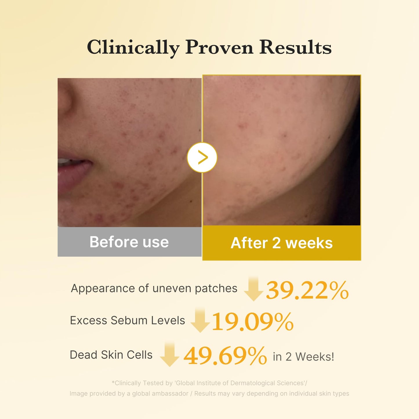 medicube Kojic Acid Turmeric Clarifying Toner Pad for Troubled Skin & Use After Spot Care | Soothing & Calming with Kojic Acid, Turmeric, Niacinamide, and Glycolic Acid | Korean Skin Care, 70 Pads