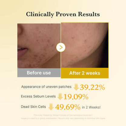 medicube Kojic Acid Turmeric Clarifying Toner Pad for Troubled Skin & Use After Spot Care | Soothing & Calming with Kojic Acid, Turmeric, Niacinamide, and Glycolic Acid | Korean Skin Care, 70 Pads