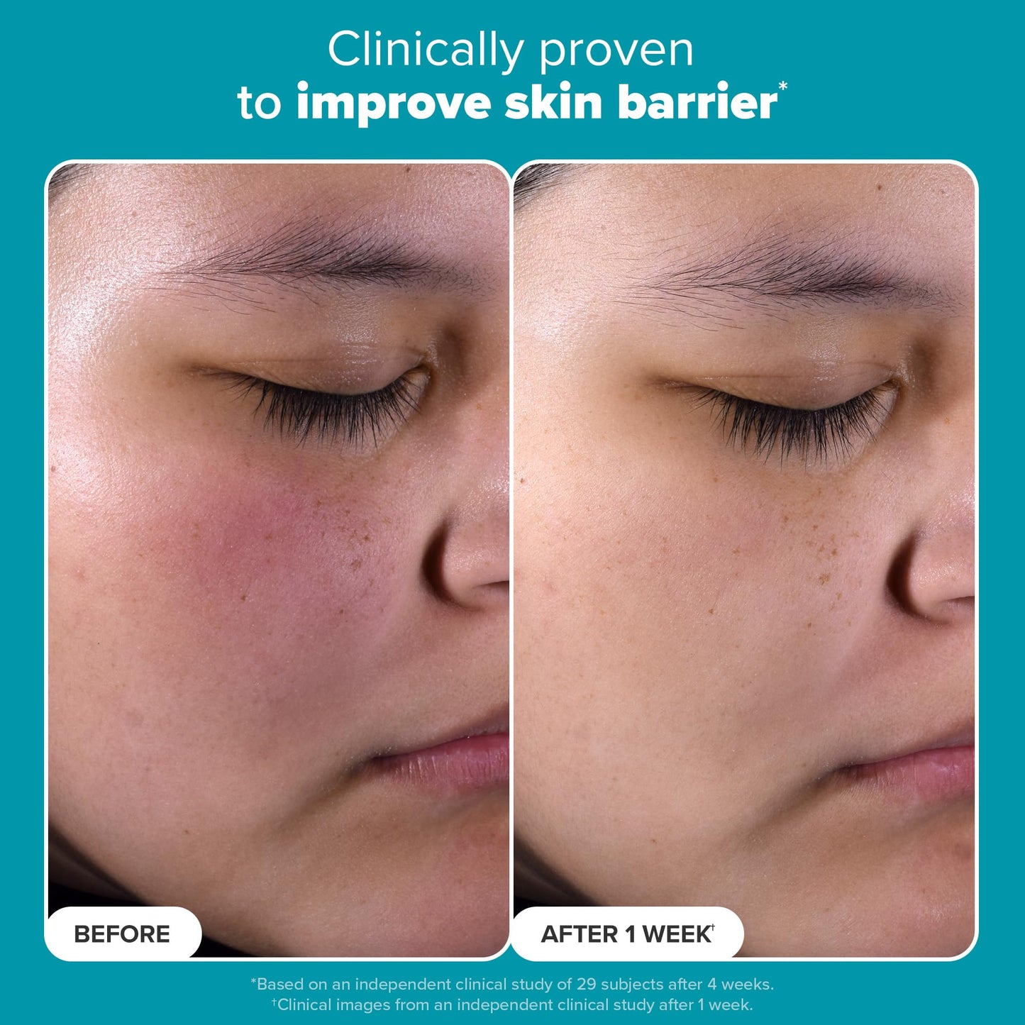 Paula's Choice SKIN PERFECTING 2% BHA Liquid Salicylic Acid Exfoliant-Facial Exfoliant for Enlarged Pores, Wrinkles & Fine Lines, Suitable for Blackhead-Prone Skin, Fragrance-Free